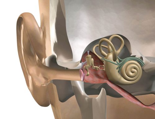 Dióhéjban az idegi halláskárosodásról
