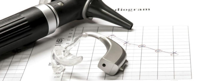 Útikalauz, amivel végre könnyebbé válik az audiogram értelmezése!